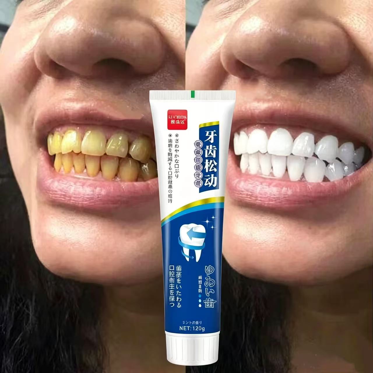 Teeth Whitening Japan - معجون أسنان ياباني مستورد لتثبيت الأسنان