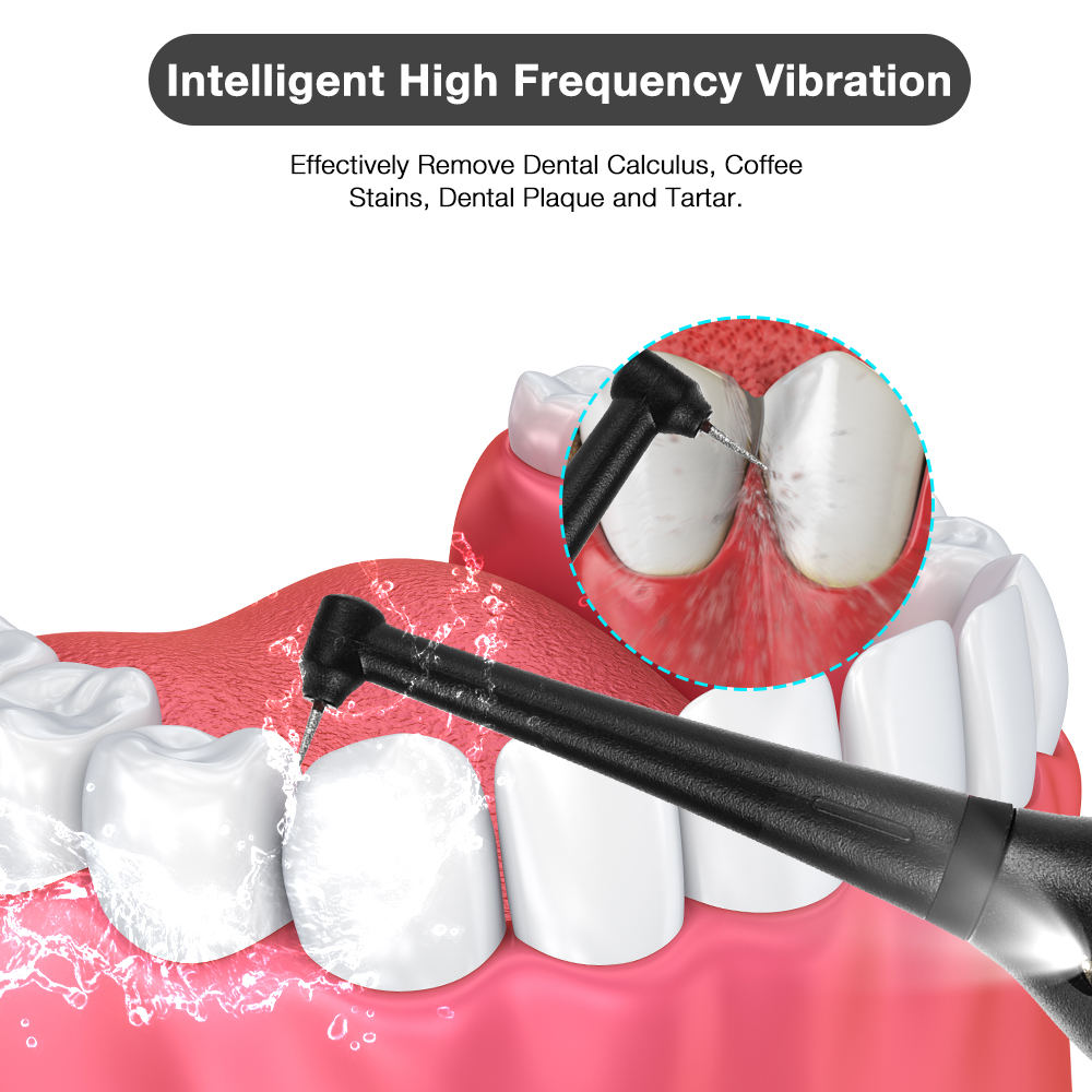 LED الكهربائية سونيك قشارة فرش - مراجعة Teeth Whitening Led Kit وسعره