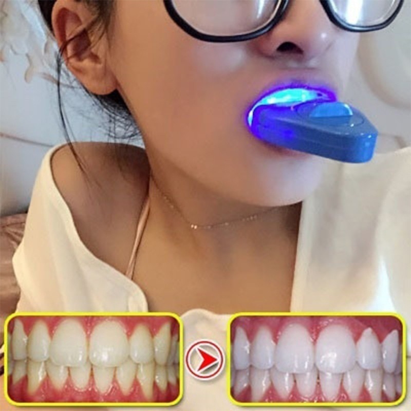 LED تبييض الأسنان ضوء تبييض ال - مراجعة Teeth Whitening Uv Kit وسعره