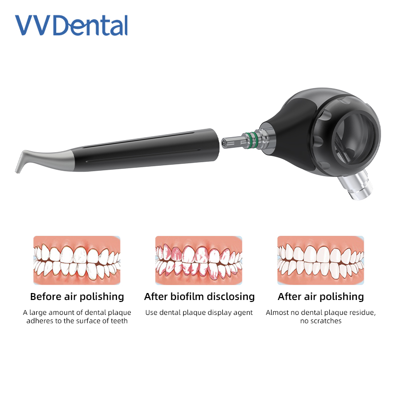 VVDental الهواء الملمع جت الهو - مراجعة Colgate Whitening Teeth وسعره