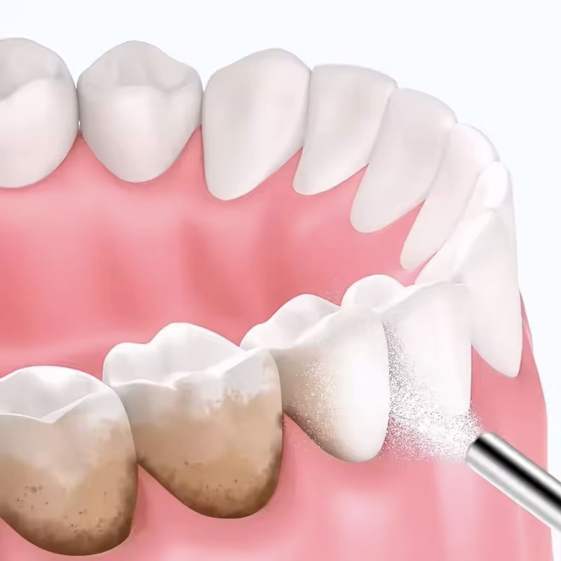 مسحوق تبييض الأسنان بالرمل 130 - مراجعة Teeth Whitening Quotes وسعره