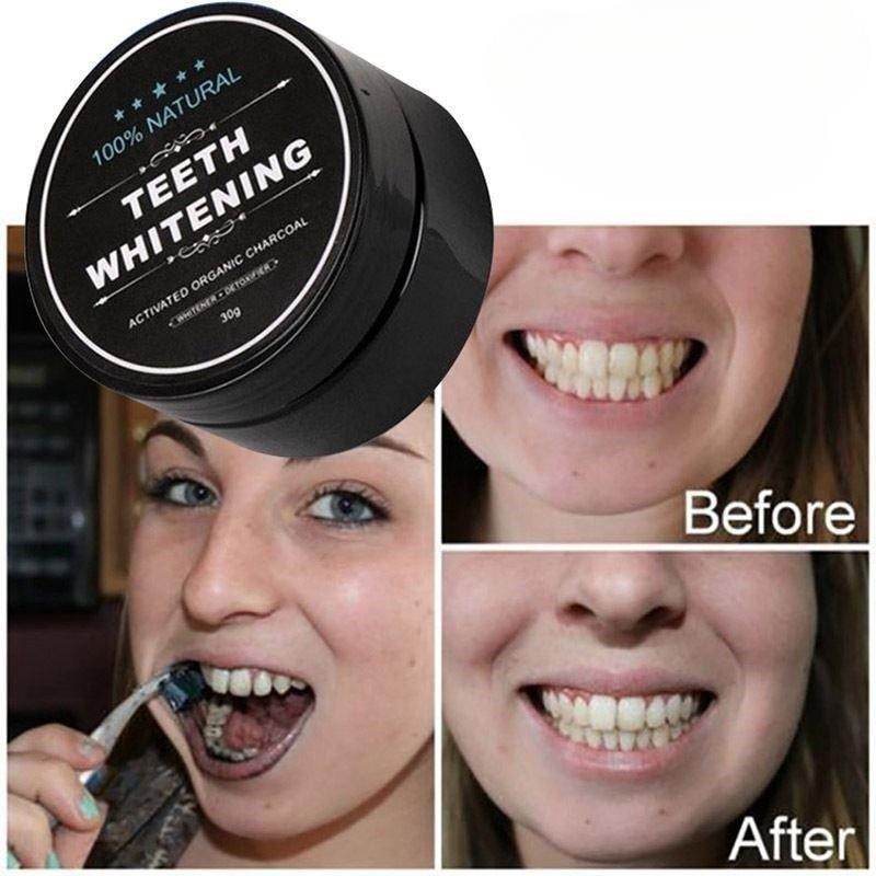 1 صندوق من مسحوق تبييض الأسنان - مراجعة Teeth Whitening Quotes وسعره