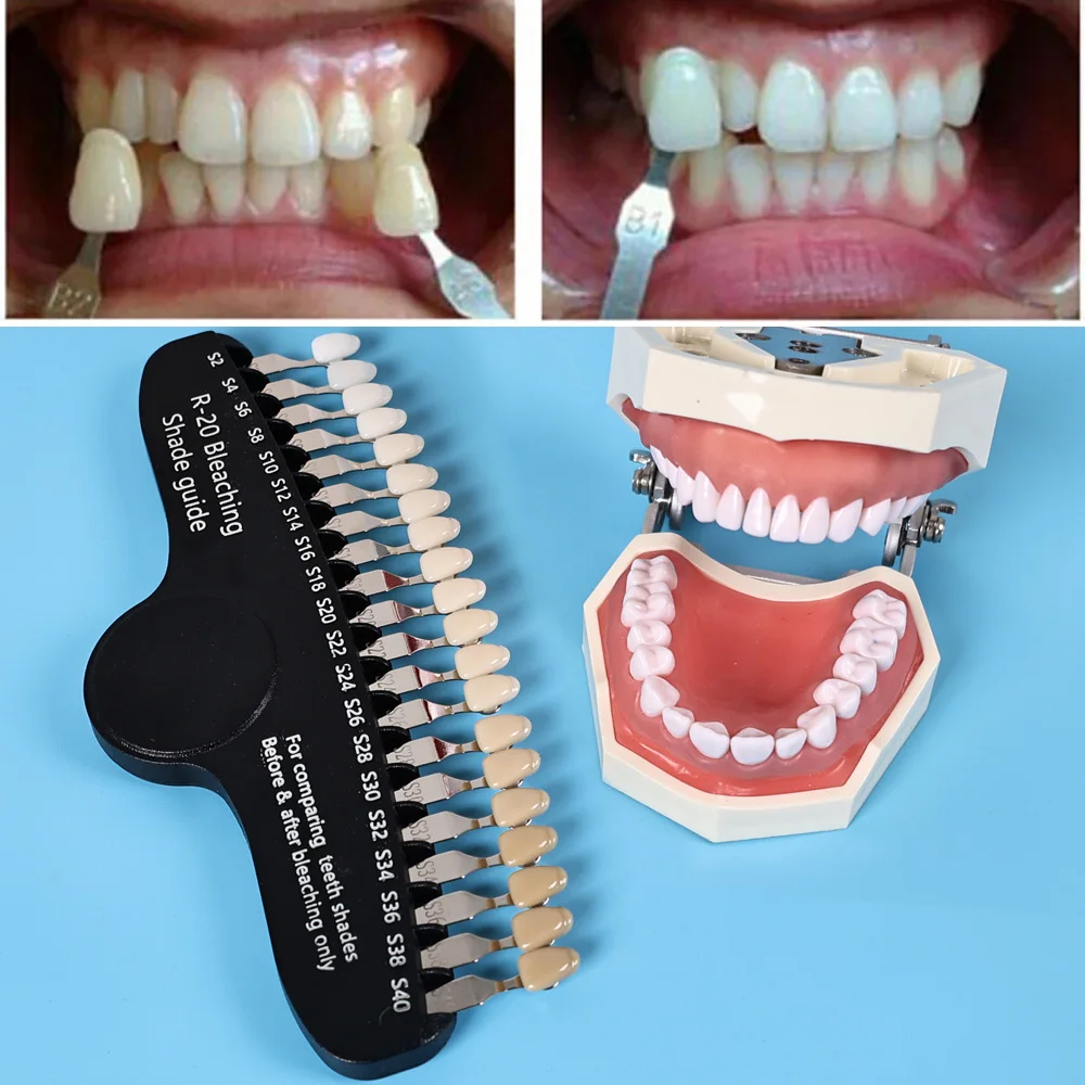 ELIJAH R-20 تبييض الظل دليل طب - مراجعة Teeth Whitening Shade Guide وسعره