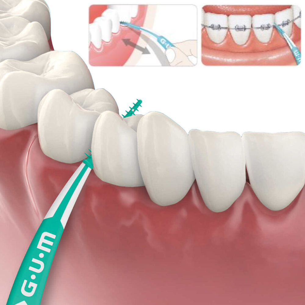 اللثة لينة يختار المتقدمة الصغ - مراجعة Teeth Whitening Japan وسعره