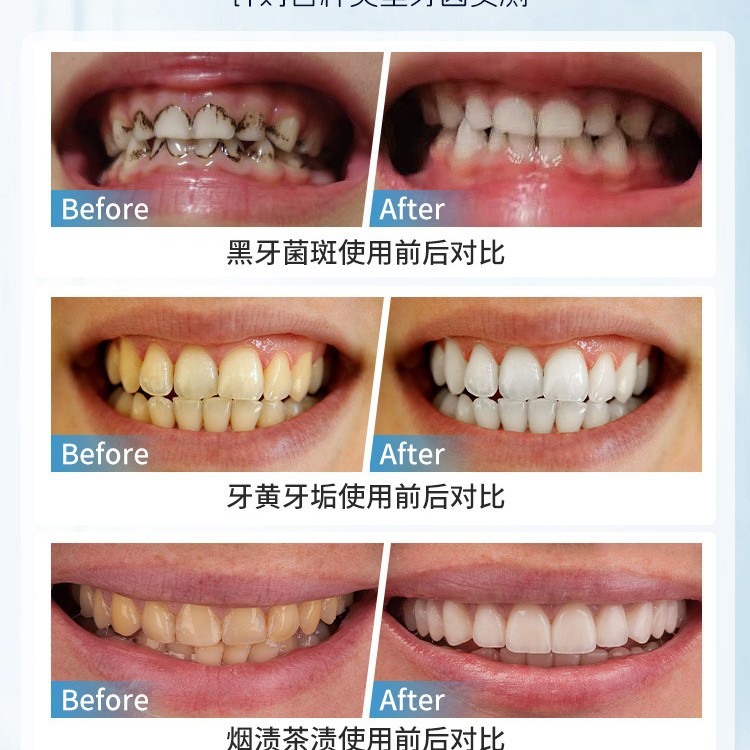 فرشاة يابانية يدوية لإزالة بقع - مراجعة Teeth Whitening Japan وسعره