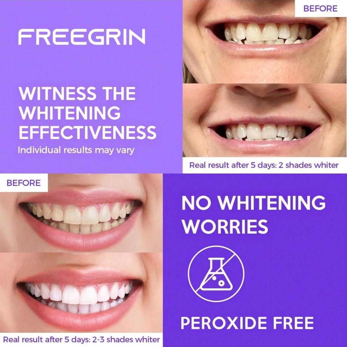 ديلوكس تبييض الأسنان ملصقات 7/ - مراجعة Teeth Whitening Quotes وسعره