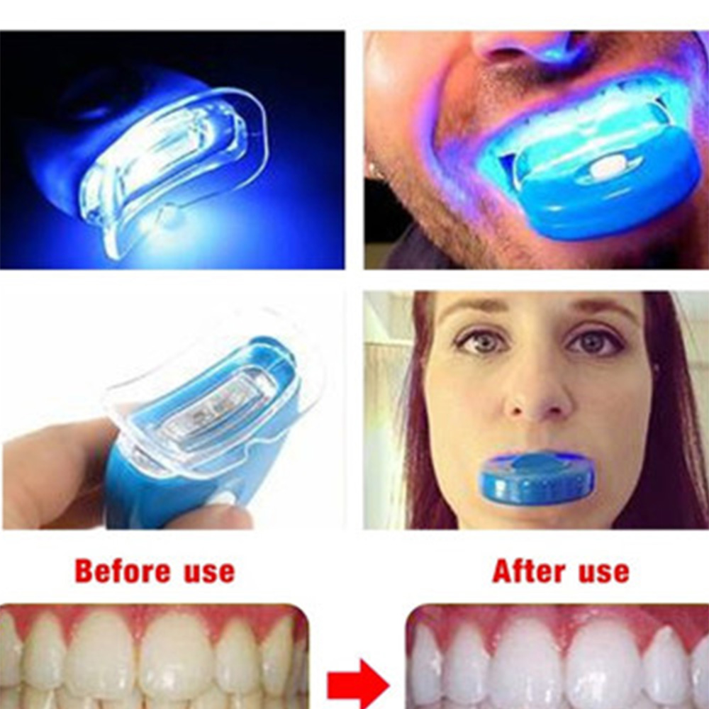 جديد الأزرق Led تبييض الأسنان  - مراجعة Teeth Whitening Uv Kit وسعره