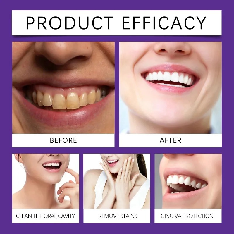 مسحوق معدني لتلميع الأسنان بال - مراجعة Teeth Whitening Quotes وسعره